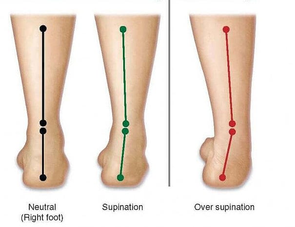 back to motion - Over supination